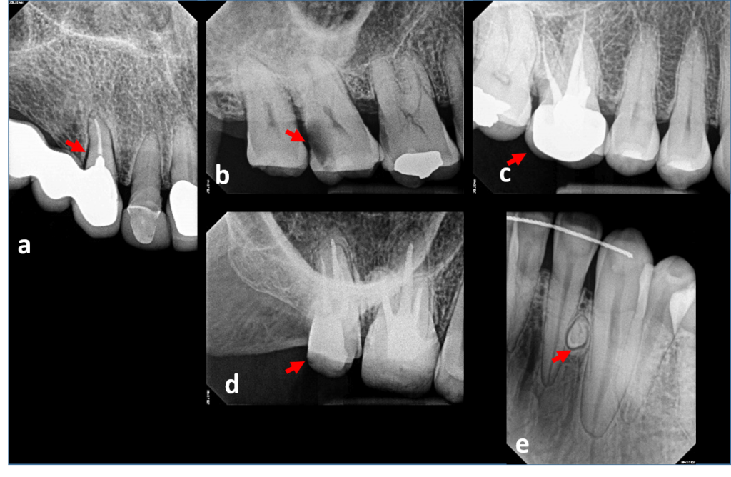 Importancia De Los Informes Radiogr Ficos En La Pr Ctica Dental General