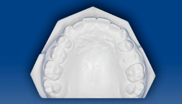 Modelos De Estudio – Dento Metric | Radiología Dental, Oral Y Maxilofacial