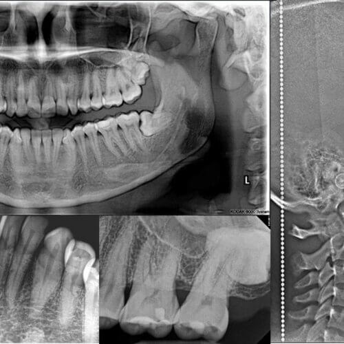 Radiologí­a Dental Digital