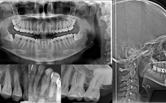 Radiologí­a Dental Digital