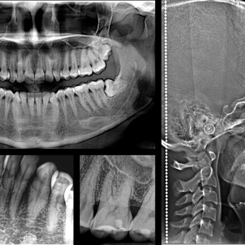 Radiologí­a Dental Digital