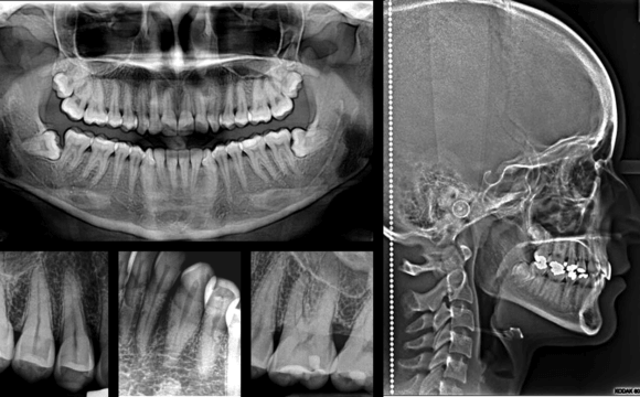 Radiologí­a Dental Digital