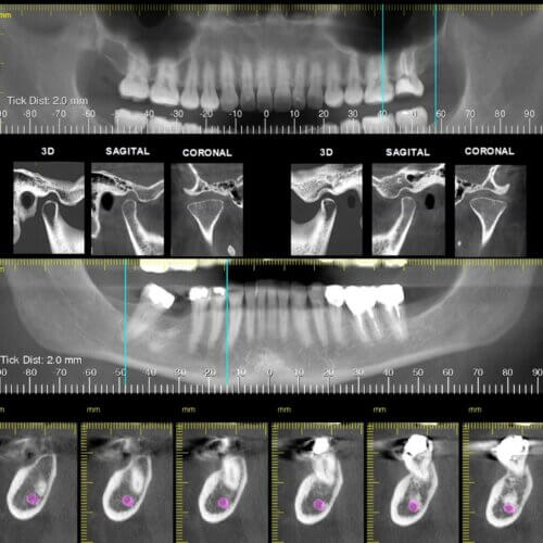 Tomografia Dental y Maxilofacial (Cone Beam)