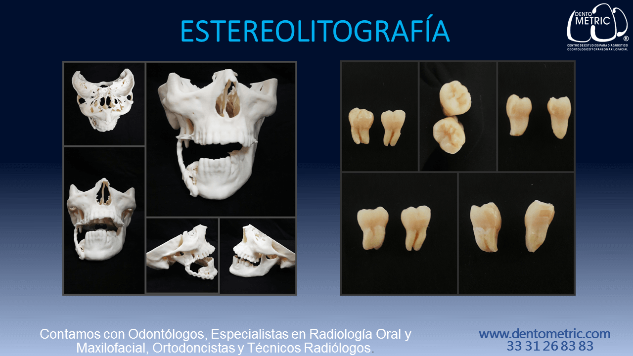 Dento Metric | Radiología Dental, Oral Y Maxilofacial – Dento Metric ...